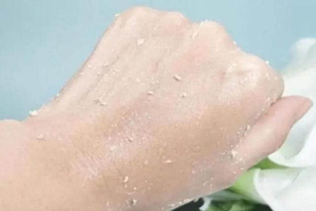 去角质对皮肤有伤害吗 ㄠソ侵实奈：